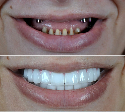 Slider image (6) Dis 212 - Dental Aesthetics Facility